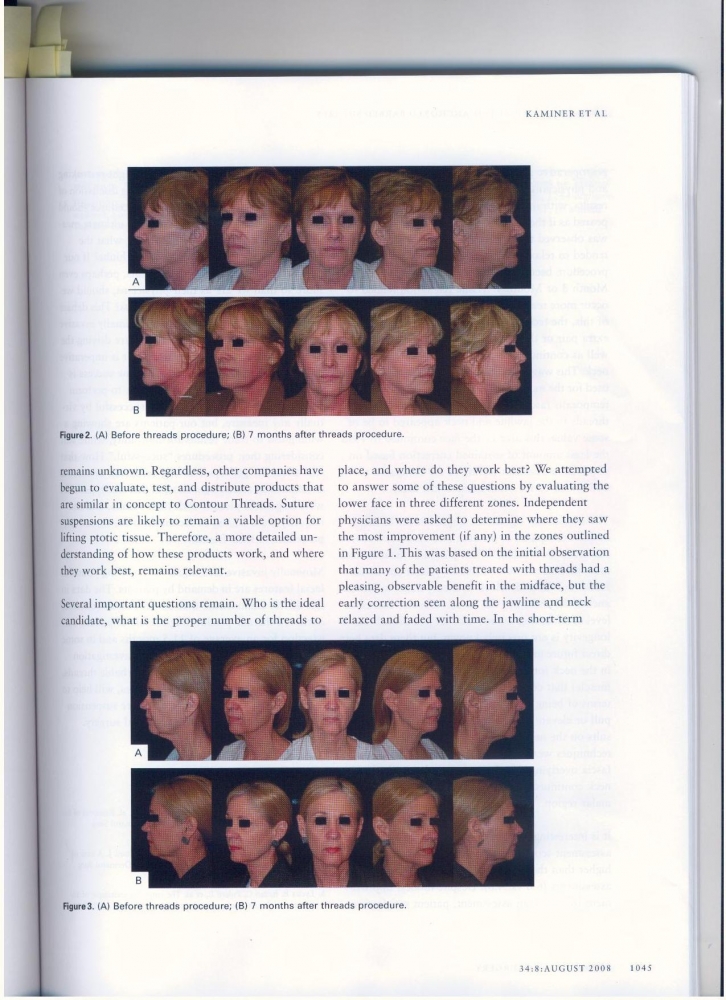 Dermatologic Surgery Volume 34 number 8 August 2008
