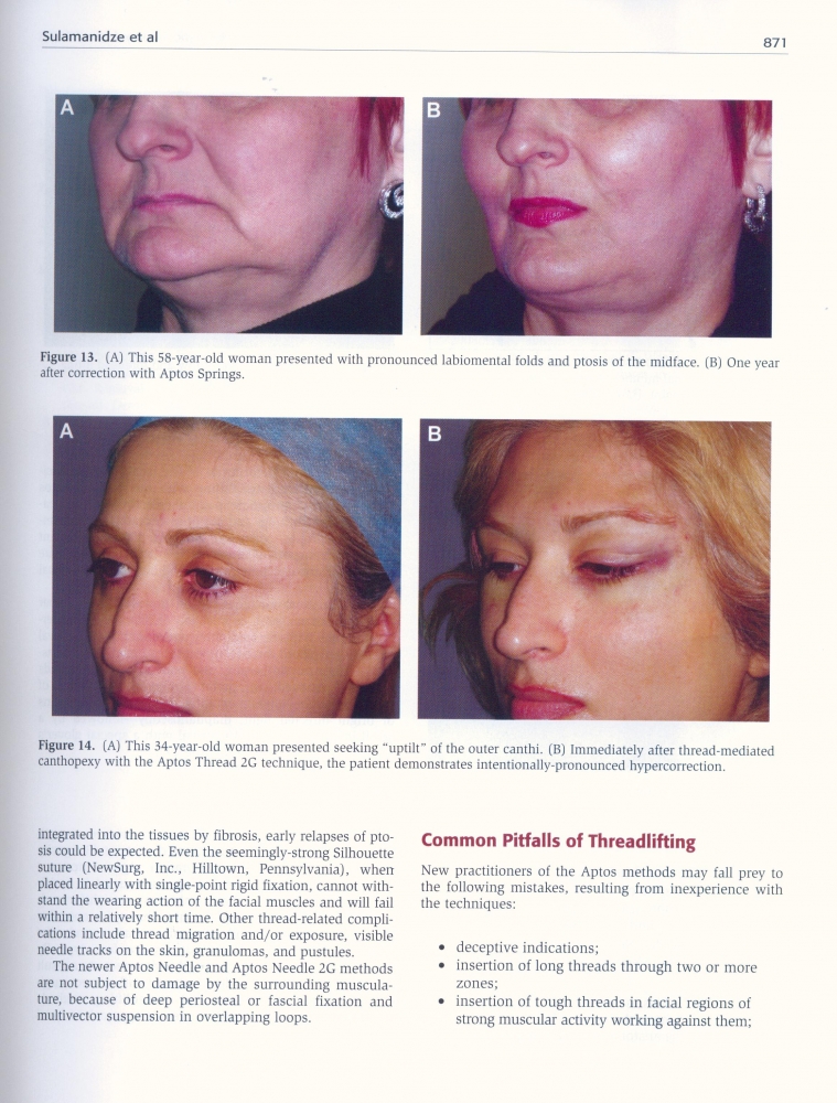 Aesthetic Surgery Journal Volume 31, Issue 8, Nov 2011