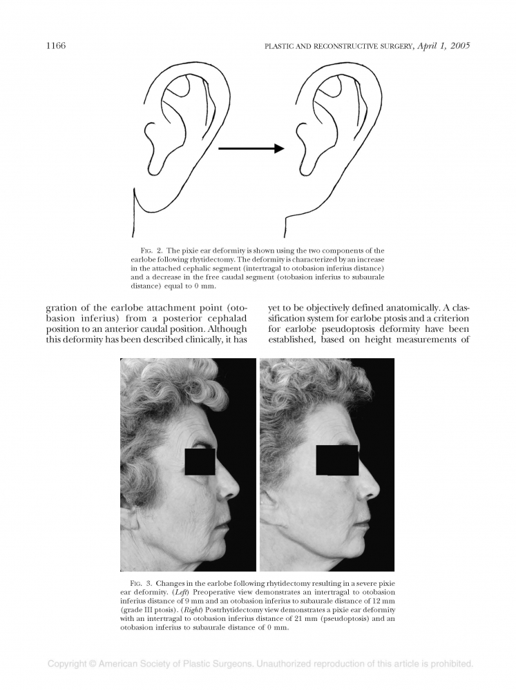 Plastic and reconstructive surgery Volume 118 number 2 Aug 2006 Plastic and reconstructive surgery Volume 118 number 2 Aug 2006
