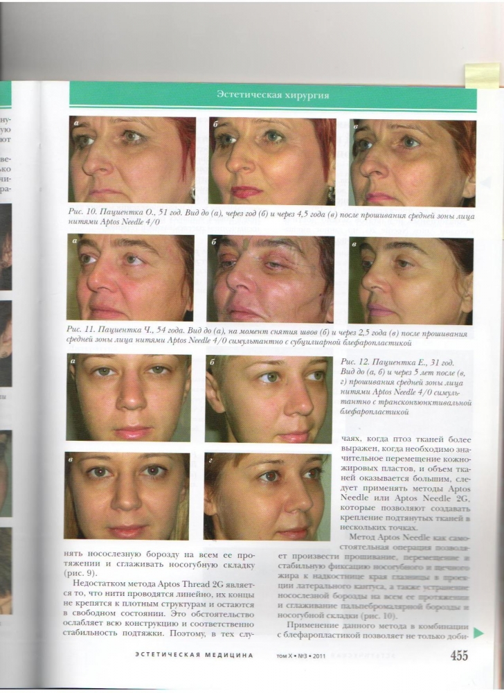 Эстетическая медицина 10-3-2011 Эстетическая медицина 10-3-2011