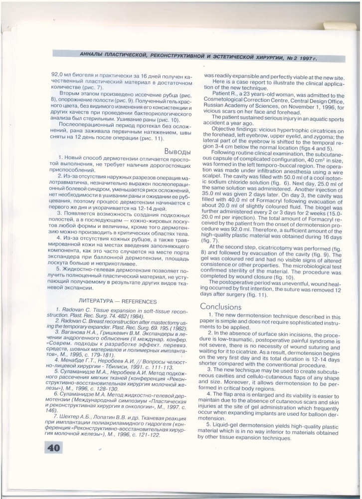 Анналы пластической реконструктивной и эстетической хирургии 2-1997