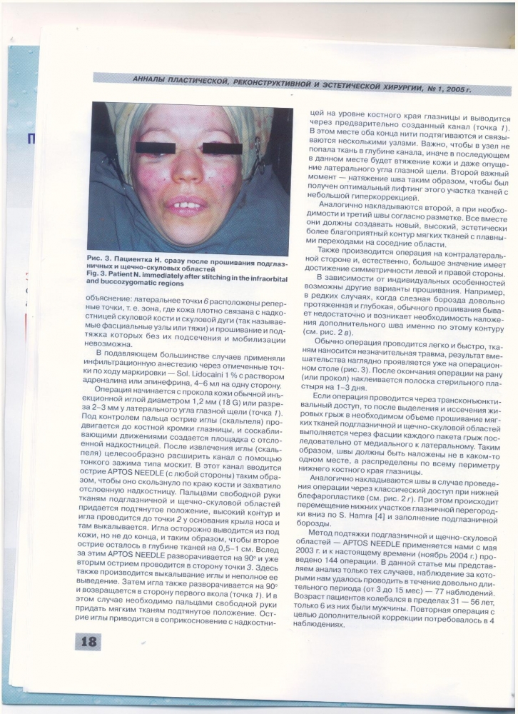 Анналы пластической реконструктивной и эстетической хирургии 1-2005 Анналы пластической реконструктивной и эстетической хирургии 1-2005