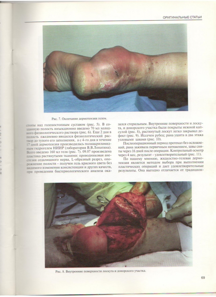 Анналы хирургии, №2 / 1997