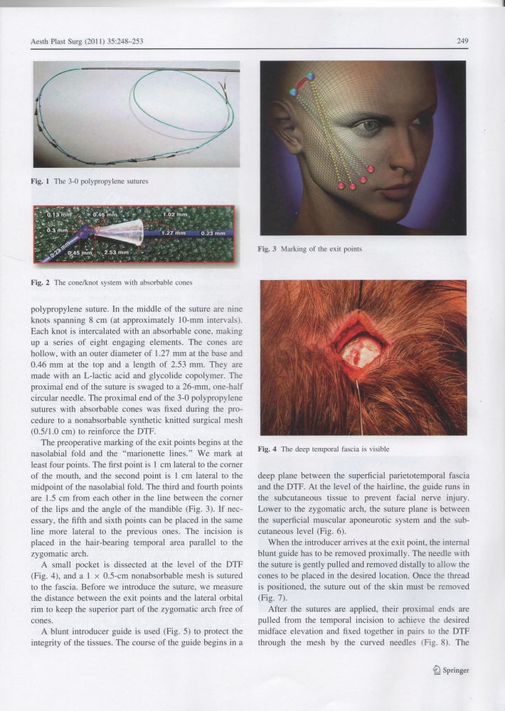 Aesthetic Plastic Surgery Volume 35 Issue 2 Apr 2011