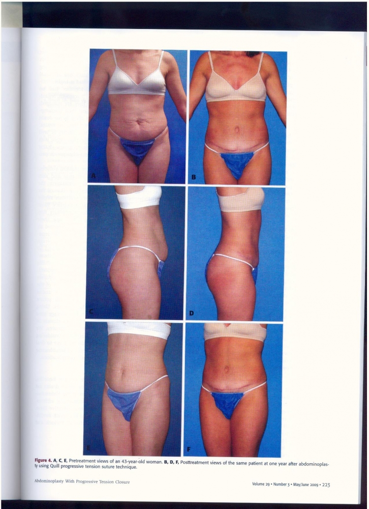 Aesthetic Surgery Journal Volume 32, Issue 1, Jan 2012