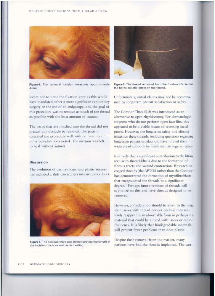 Dermatologic Surgery Volume 34 number 8 August 2008 Dermatologic Surgery Volume 34 number 8 August 2008