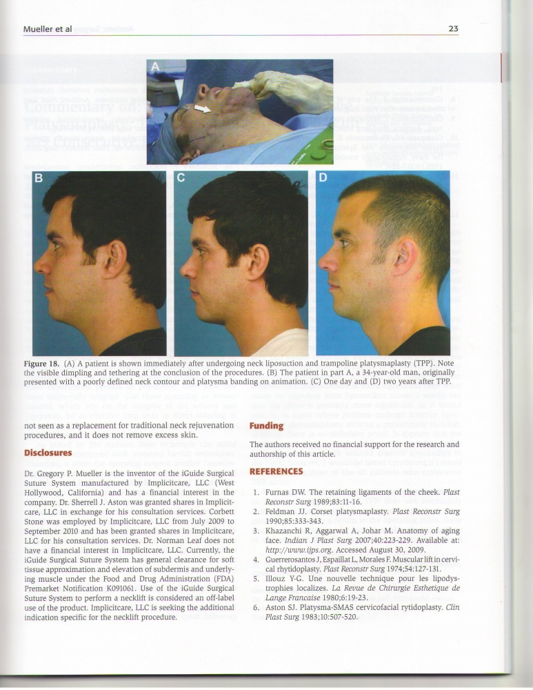 Aesthetic Surgery Journal Volume 32, Issue 1, Jan 2012 Aesthetic Surgery Journal Volume 32, Issue 1, Jan 2012