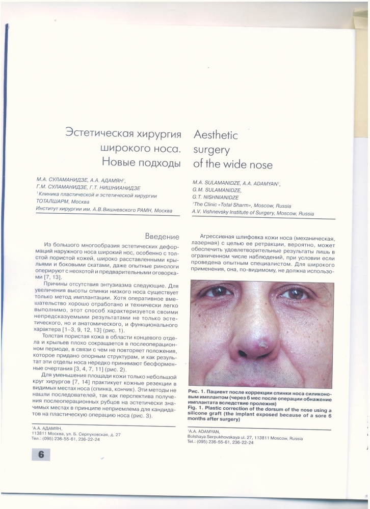 Анналы пластической реконструктивной и эстетической хирургии 3-2004