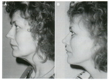 Dermatologic Surgery. May 2002. Number 5. Volume 28
