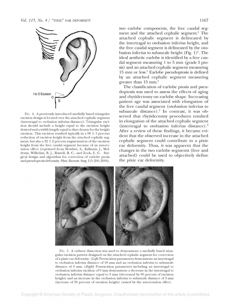Plastic and reconstructive surgery Volume 118 number 2 Aug 2006 Plastic and reconstructive surgery Volume 118 number 2 Aug 2006