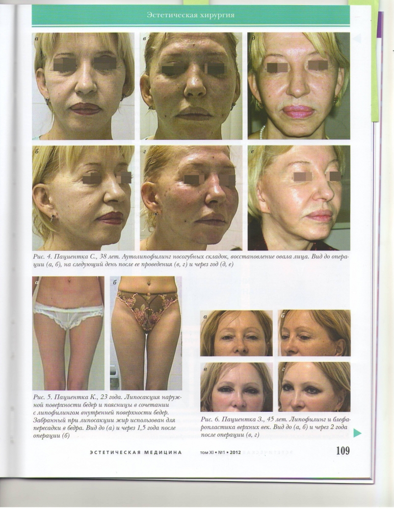 Вестник эстетической медицины, т.20, №1 / 2012