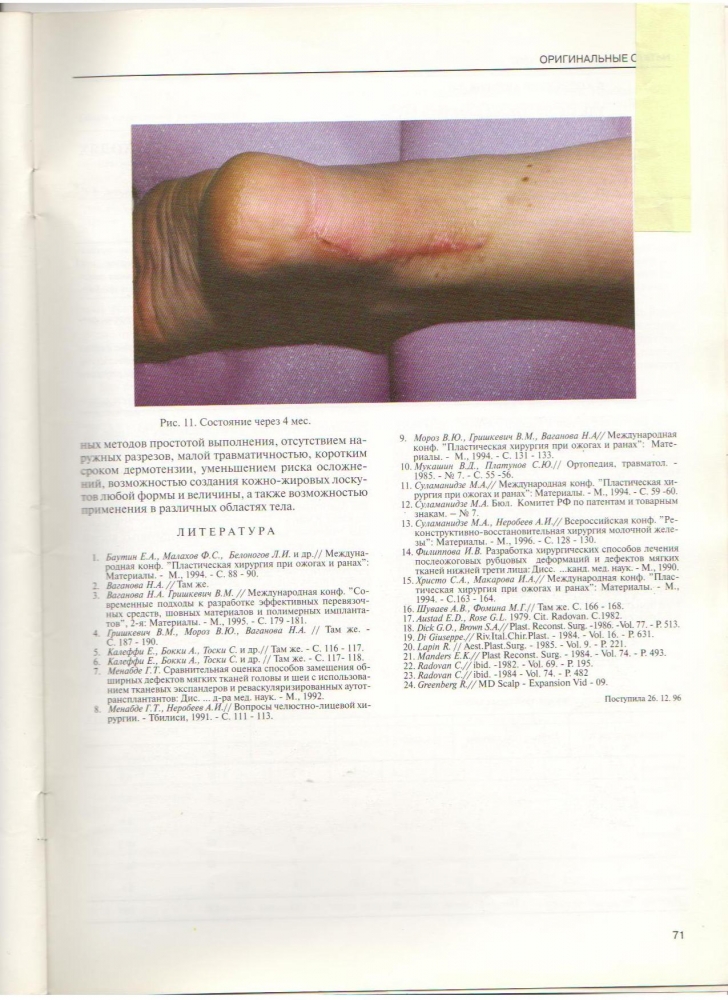Анналы хирургии, №2 / 1997